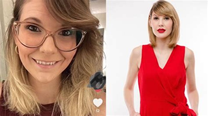 Ashley Leechin Before Surgery | How Did She Look Previously