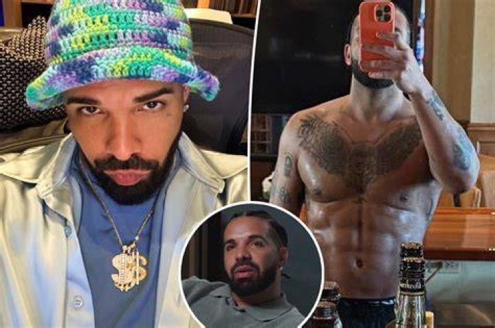 Drake | Surgery Rumors 2024